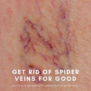 spider veins