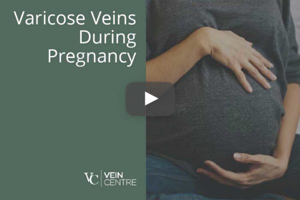 dr julie boll best vein doctor board certified vascular surgeon at the vein centre in nashville belle meade and franklin tn