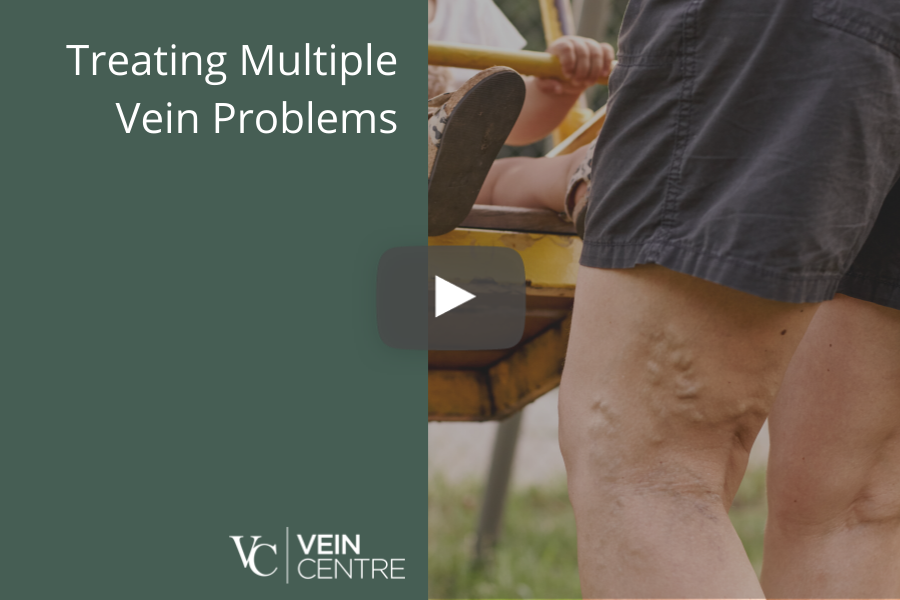 treating multiple vein problems with dr roger bonau
