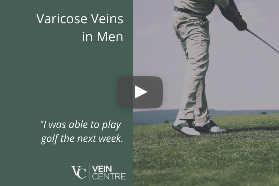 varicose veins nashville tn