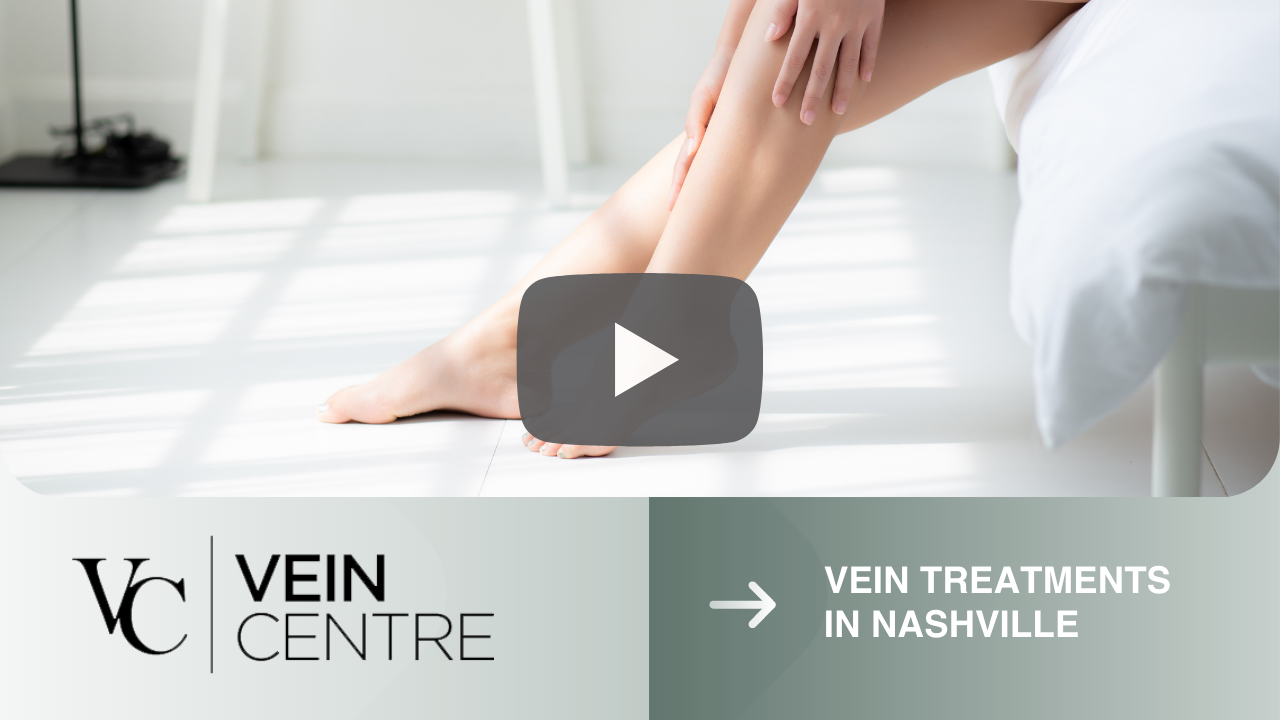How do I get rid of my spider veins?” Find out here at Cumberland Skin.